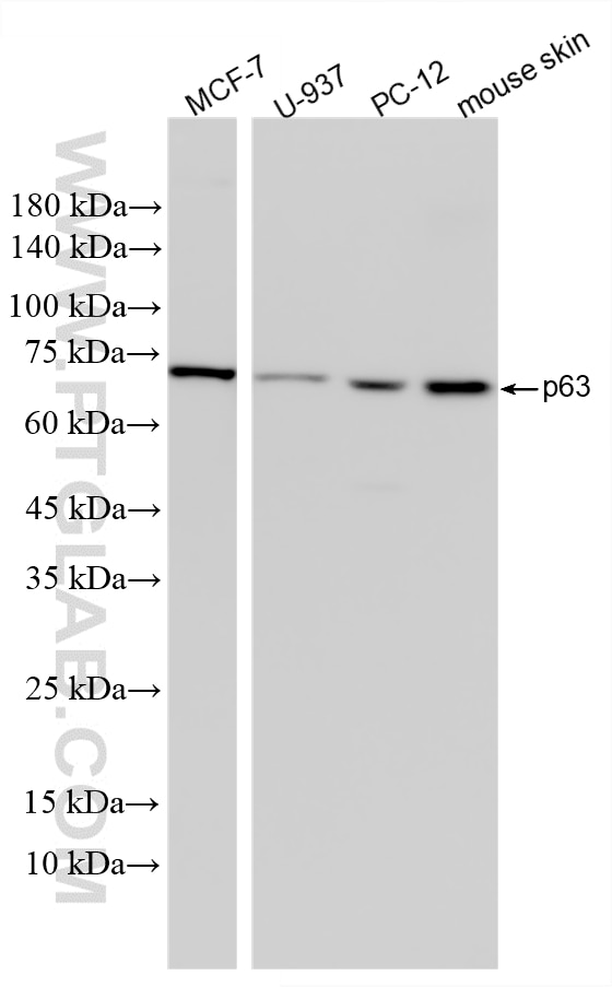 Western Blot (WB) analysis of various lysates using DeltaN p63 Recombinant monoclonal antibody (86154-11-RR)