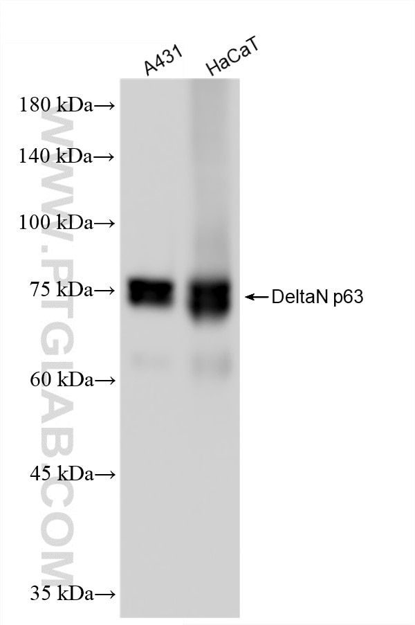 Western Blot (WB) analysis of various lysates using DeltaN p63 Recombinant monoclonal antibody (86154-11-RR)