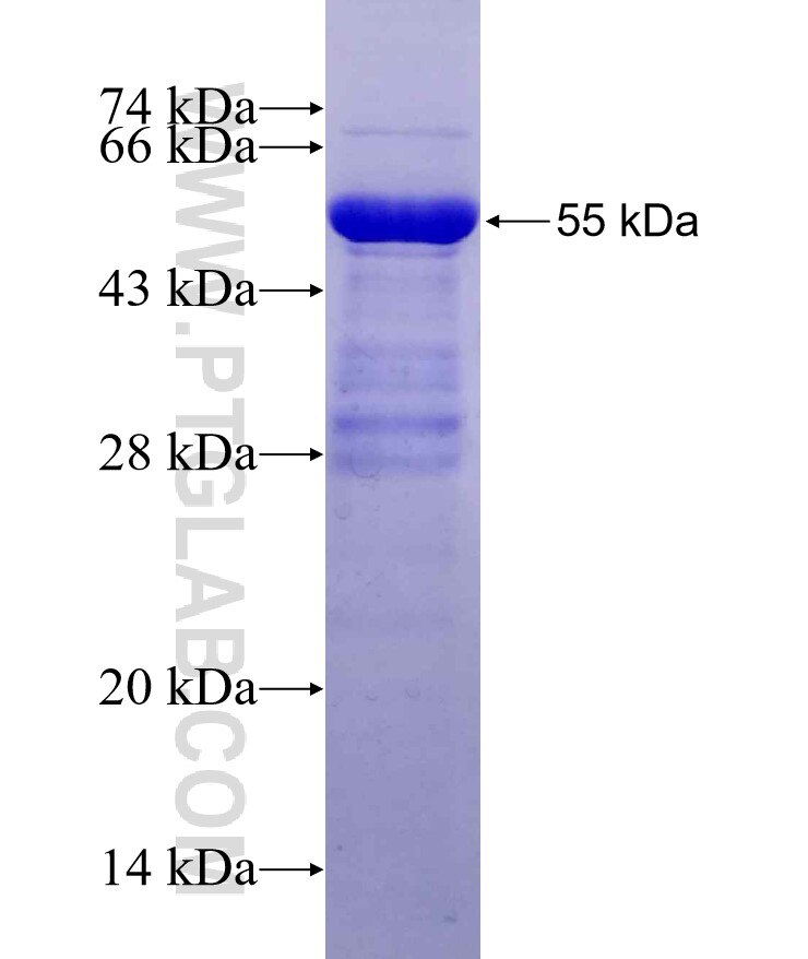 Dendrin fusion protein Ag29508 SDS-PAGE