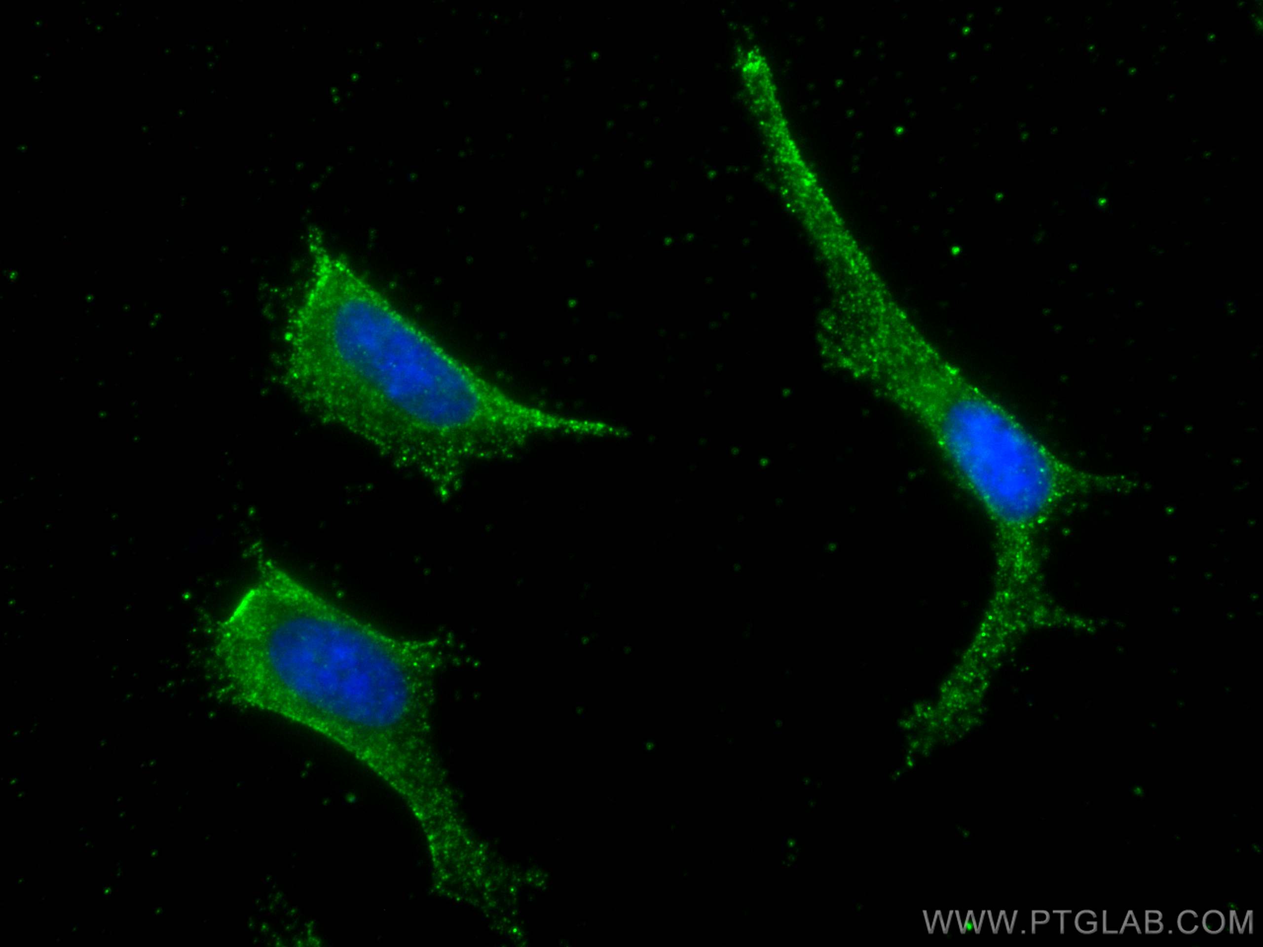 Immunofluorescence (IF) / fluorescent staining of SH-SY5Y cells using Dermatopontin Monoclonal antibody (66348-1-Ig)