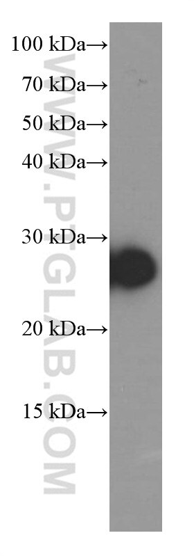 Western Blot (WB) analysis of human testis tissue using Dermatopontin Monoclonal antibody (66348-1-Ig)