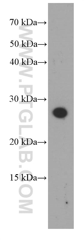 Western Blot (WB) analysis of rat skin tissue using Dermatopontin Monoclonal antibody (66348-1-Ig)