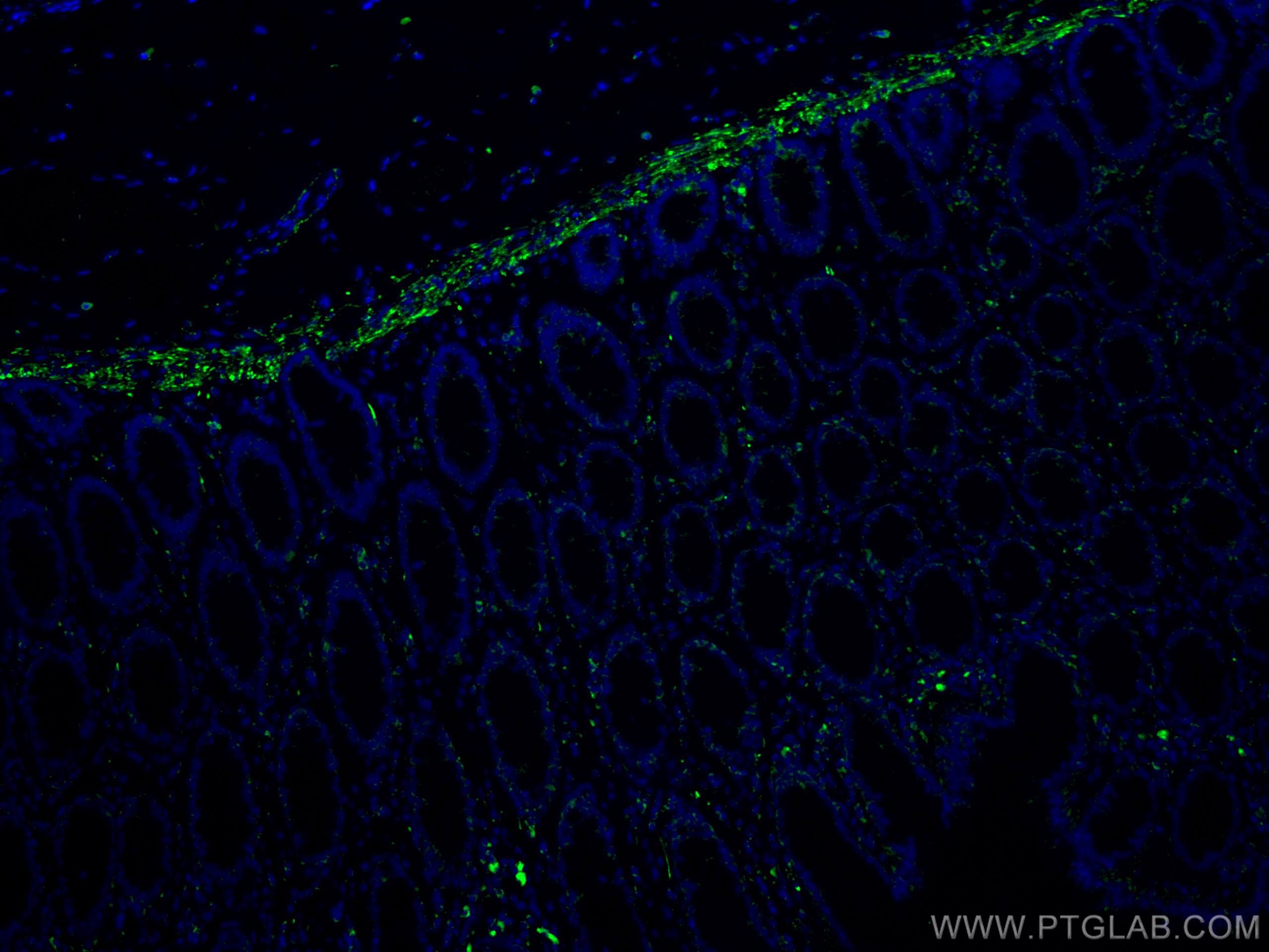 Immunofluorescence (IF) / fluorescent staining of human colon tissue using Desmin Monoclonal antibody (67793-1-Ig)