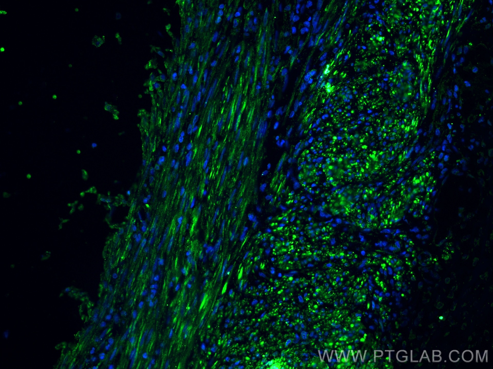 Immunofluorescence (IF) / fluorescent staining of human appendicitis tissue using Desmin Monoclonal antibody (67793-1-Ig)