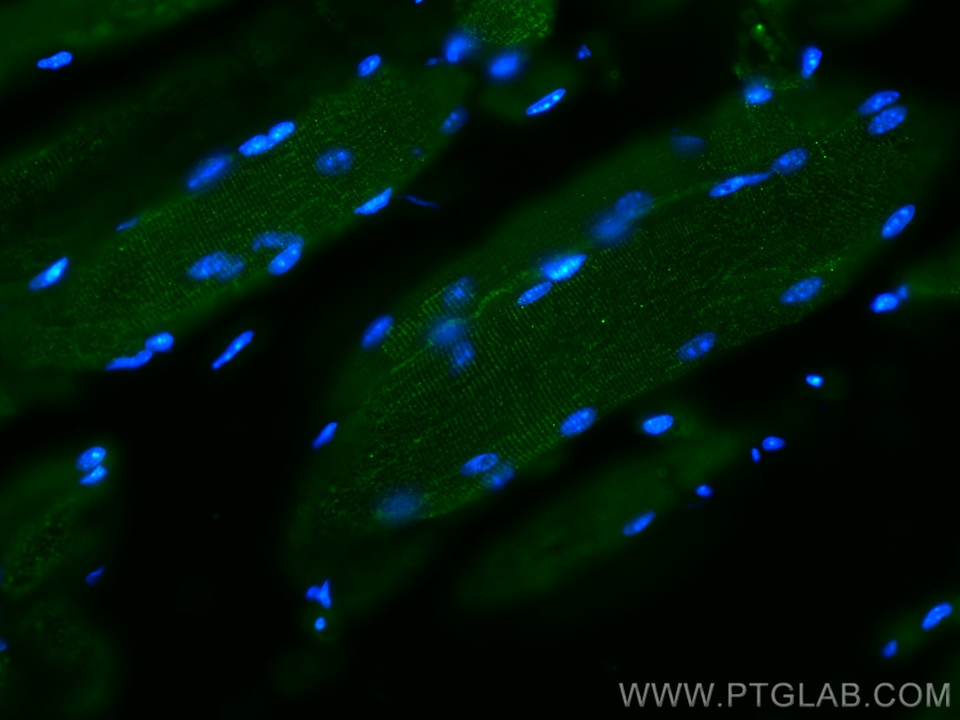 Immunofluorescence (IF) / fluorescent staining of mouse skeletal muscle tissue using Desmin Monoclonal antibody (67793-1-Ig)