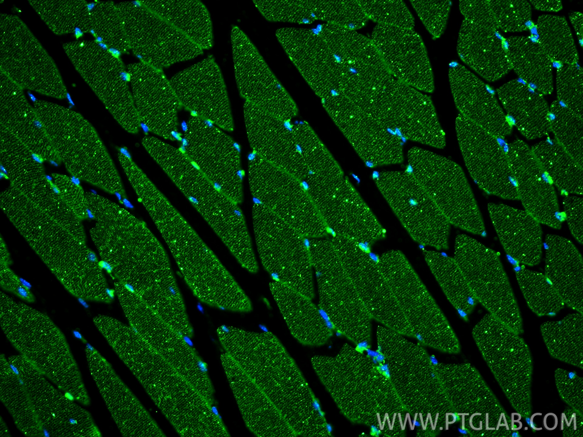 Immunofluorescence (IF) / fluorescent staining of mouse skeletal muscle tissue using Desmin Monoclonal antibody (67793-1-Ig)
