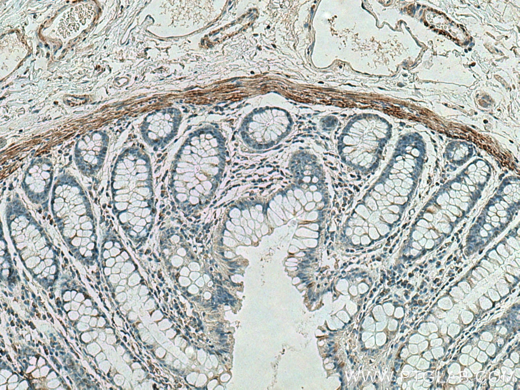 Immunohistochemistry (IHC) staining of human colon tissue using Desmin Monoclonal antibody (67793-1-Ig)
