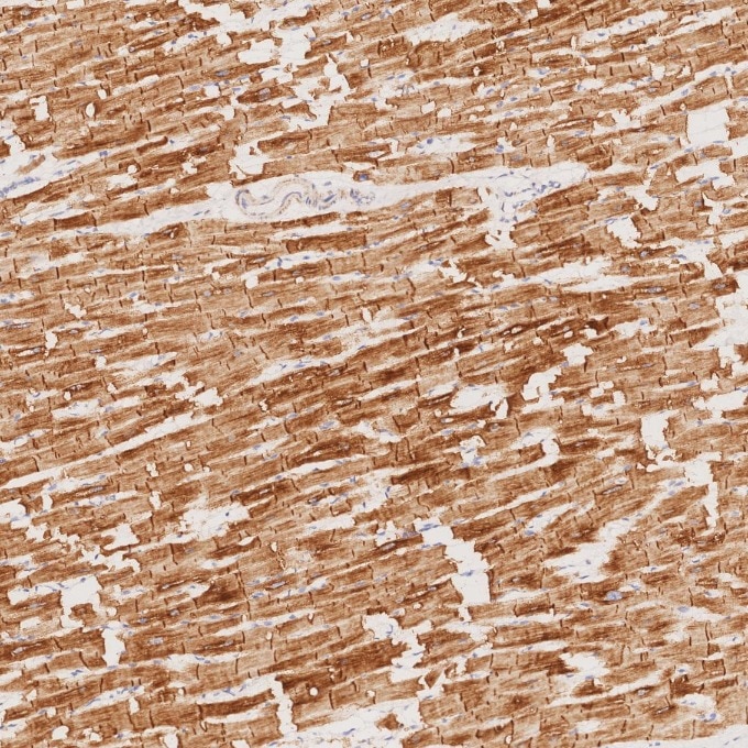 IHC staining of human heart using 67793-1-Ig Immunohistochemistry (IHC) staining of human heart tissue using Desmin Monoclonal antibody (67793-1-Ig)