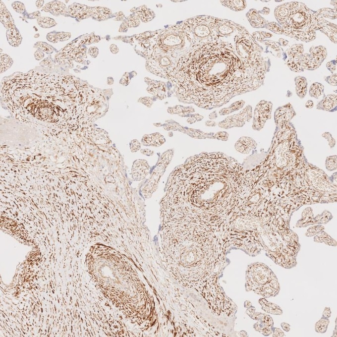 IHC staining of human placenta using 67793-1-Ig Immunohistochemistry (IHC) staining of human placenta tissue using Desmin Monoclonal antibody (67793-1-Ig)