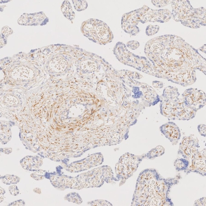 IHC staining of human placenta using 67793-1-Ig Immunohistochemistry (IHC) staining of human placenta tissue using Desmin Monoclonal antibody (67793-1-Ig)