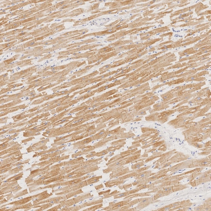 IHC staining of human heart using 67793-1-Ig Immunohistochemistry (IHC) staining of human heart tissue using Desmin Monoclonal antibody (67793-1-Ig)