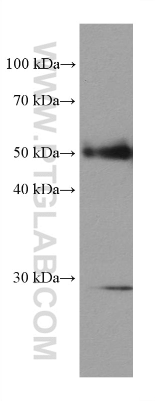 Western Blot (WB) analysis of mouse skeletal muscle tissue using Desmin Monoclonal antibody (67793-1-Ig)