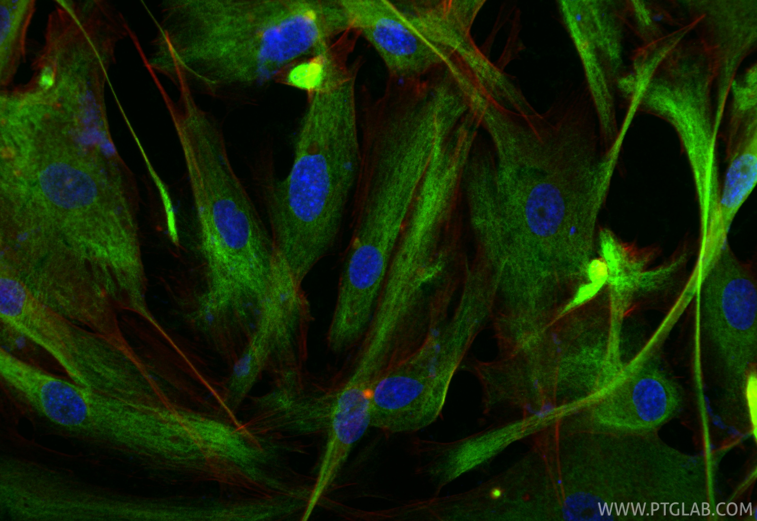 Immunofluorescent analysis of (-20°C Ethanol) fixed HSkMC cells using Desmin antibody (82748-1-RR, Clone: 1D21 ) at dilution of 1:200 and CoraLite®488-Conjugated Goat Anti-Rabbit IgG(H+L) (SA00013-2), CL594-Phalloidin (red). Immunofluorescence (IF) / fluorescent staining of HSkMC cells using Desmin Recombinant monoclonal antibody (82748-1-RR)