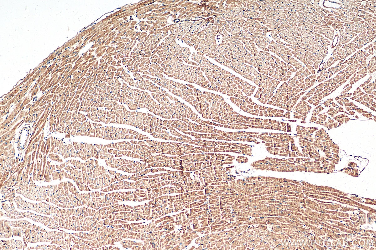 Immunohistochemistry (IHC) staining of mouse heart tissue using Desmin Recombinant antibody (82748-1-RR)