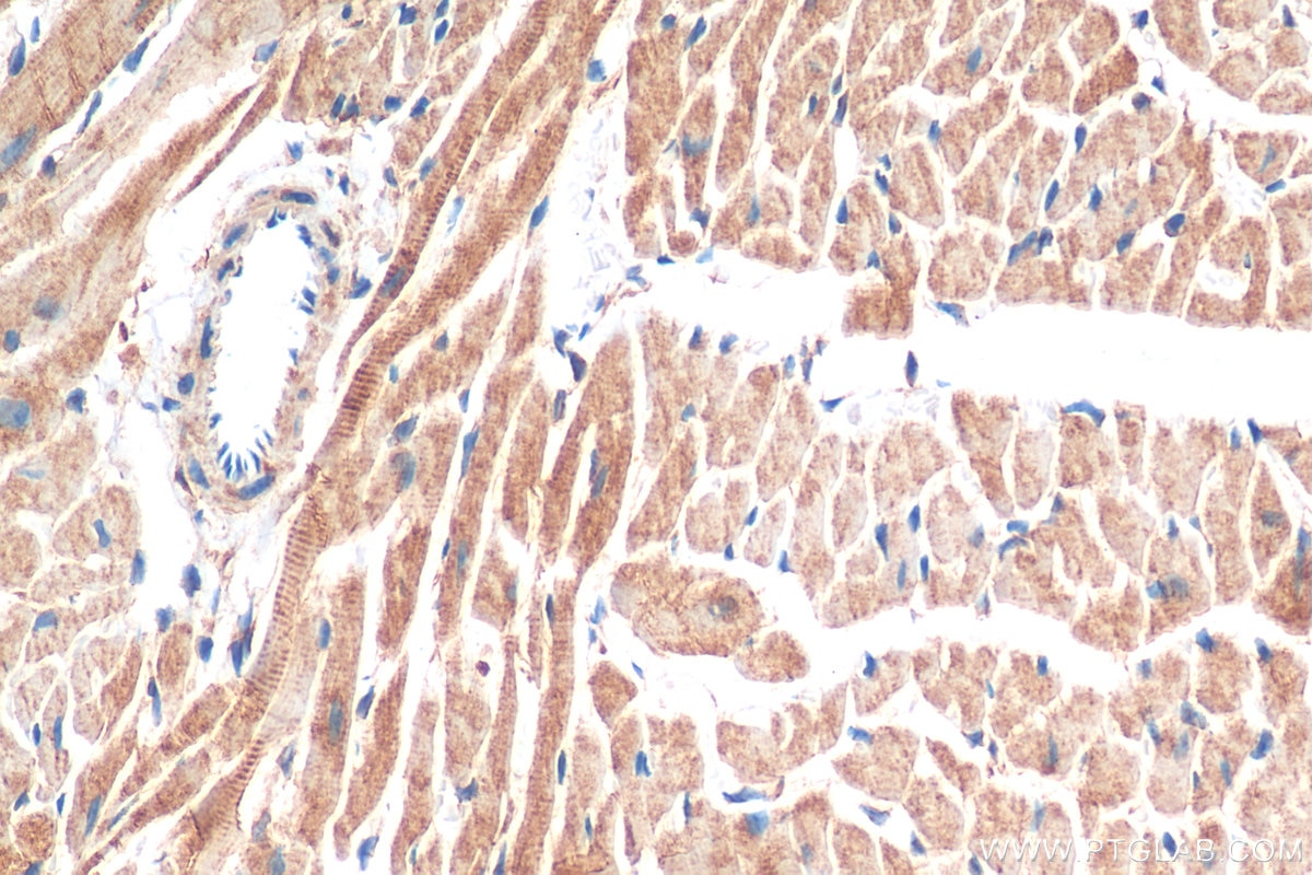 Immunohistochemistry (IHC) staining of mouse heart tissue using Desmin Recombinant antibody (82748-1-RR)