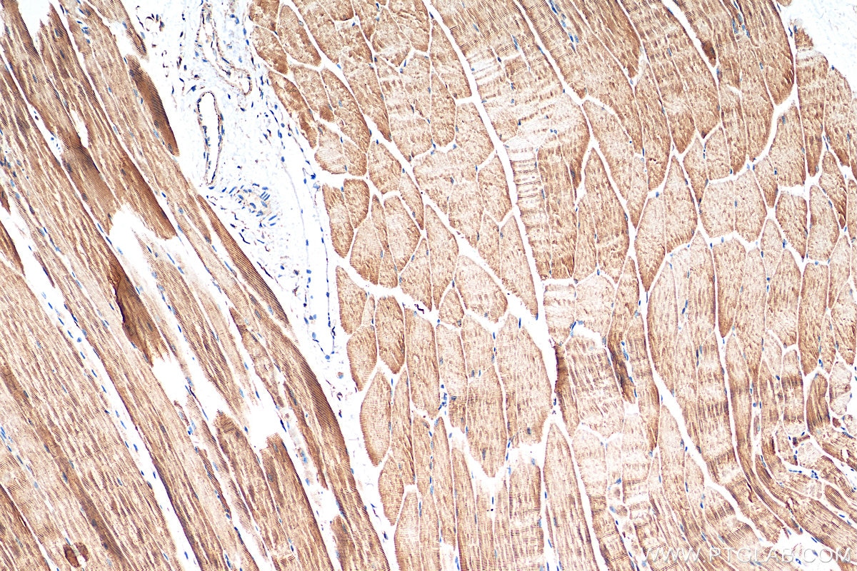 Immunohistochemistry (IHC) staining of mouse skeletal muscle tissue using Desmin Recombinant antibody (82748-1-RR)