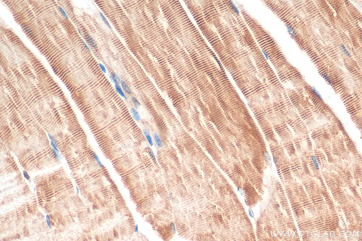 Immunohistochemistry (IHC) staining of mouse skeletal muscle tissue using Desmin Recombinant antibody (82748-1-RR)