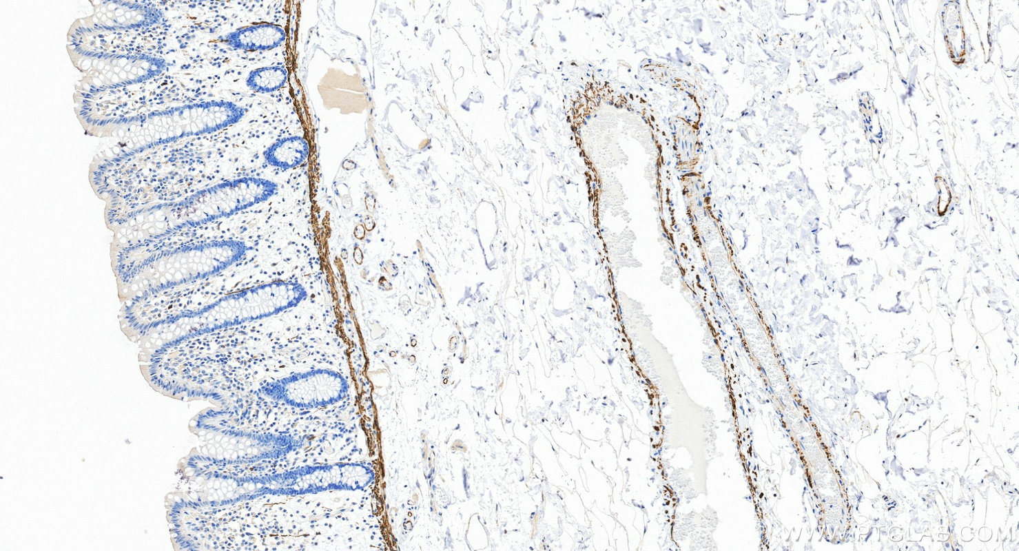 Immunohistochemistry (IHC) staining of human colon tissue using Desmin Recombinant monoclonal antibody (82748-2-RR)