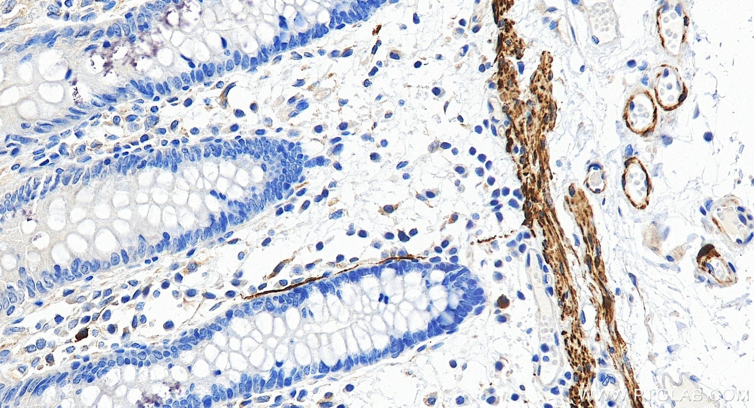 Immunohistochemistry (IHC) staining of human colon tissue using Desmin Recombinant monoclonal antibody (82748-2-RR)