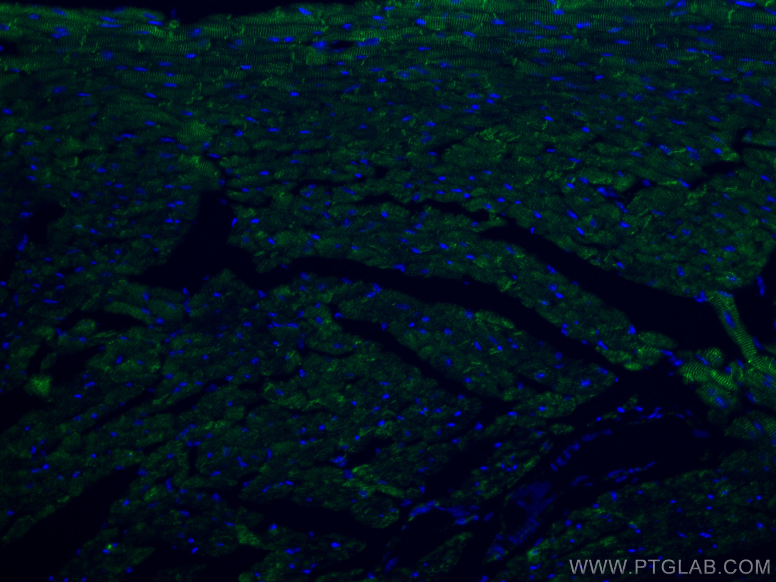 Immunofluorescence (IF) / fluorescent staining of mouse heart tissue using CoraLite®488-conjugated Desmin Polyclonal antibody (CL488-16520)