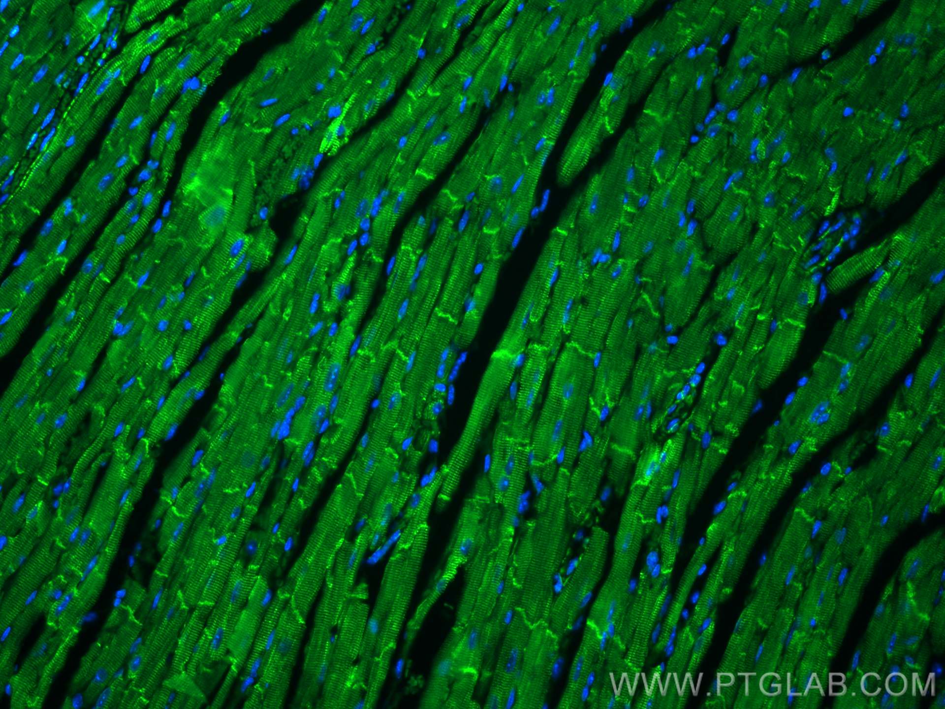 Immunofluorescence (IF) / fluorescent staining of mouse heart tissue using CoraLite® Plus 488-conjugated Desmin Polyclonal an (CL488-16520)