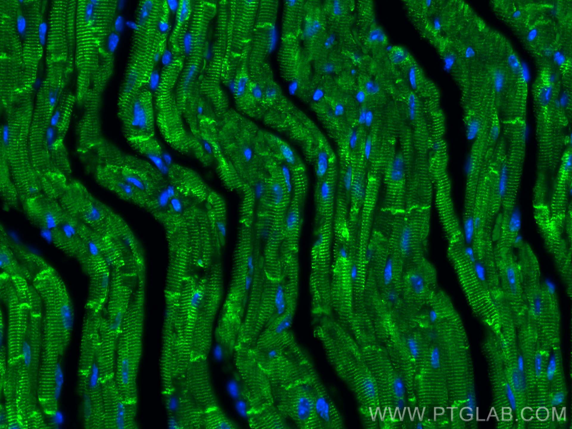 Immunofluorescence (IF) / fluorescent staining of mouse heart tissue using CoraLite® Plus 488-conjugated Desmin Polyclonal an (CL488-16520)