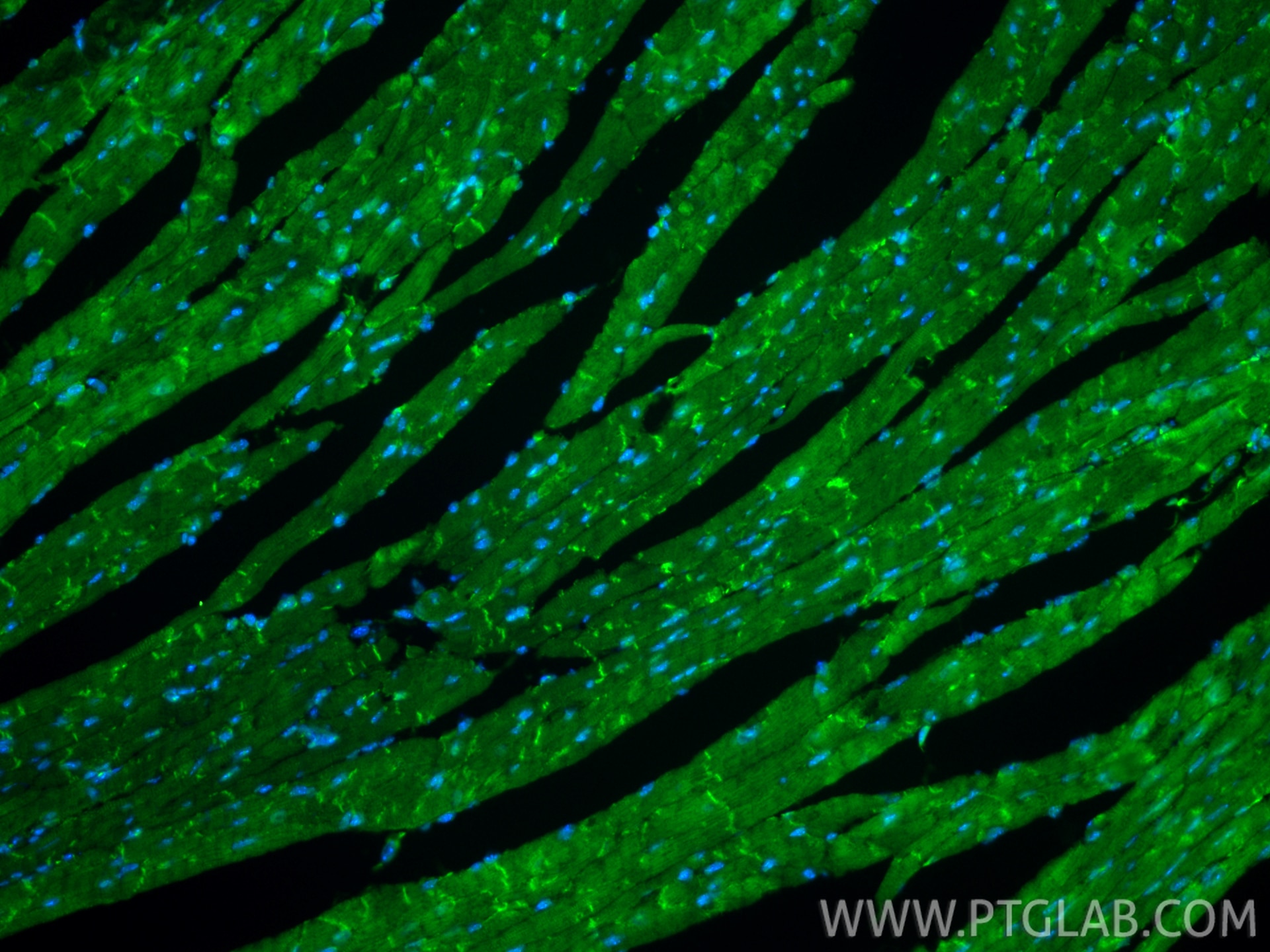 Immunofluorescence (IF) / fluorescent staining of mouse heart tissue using CoraLite® Plus 488-conjugated Desmin Recombinant m (CL488-82748)