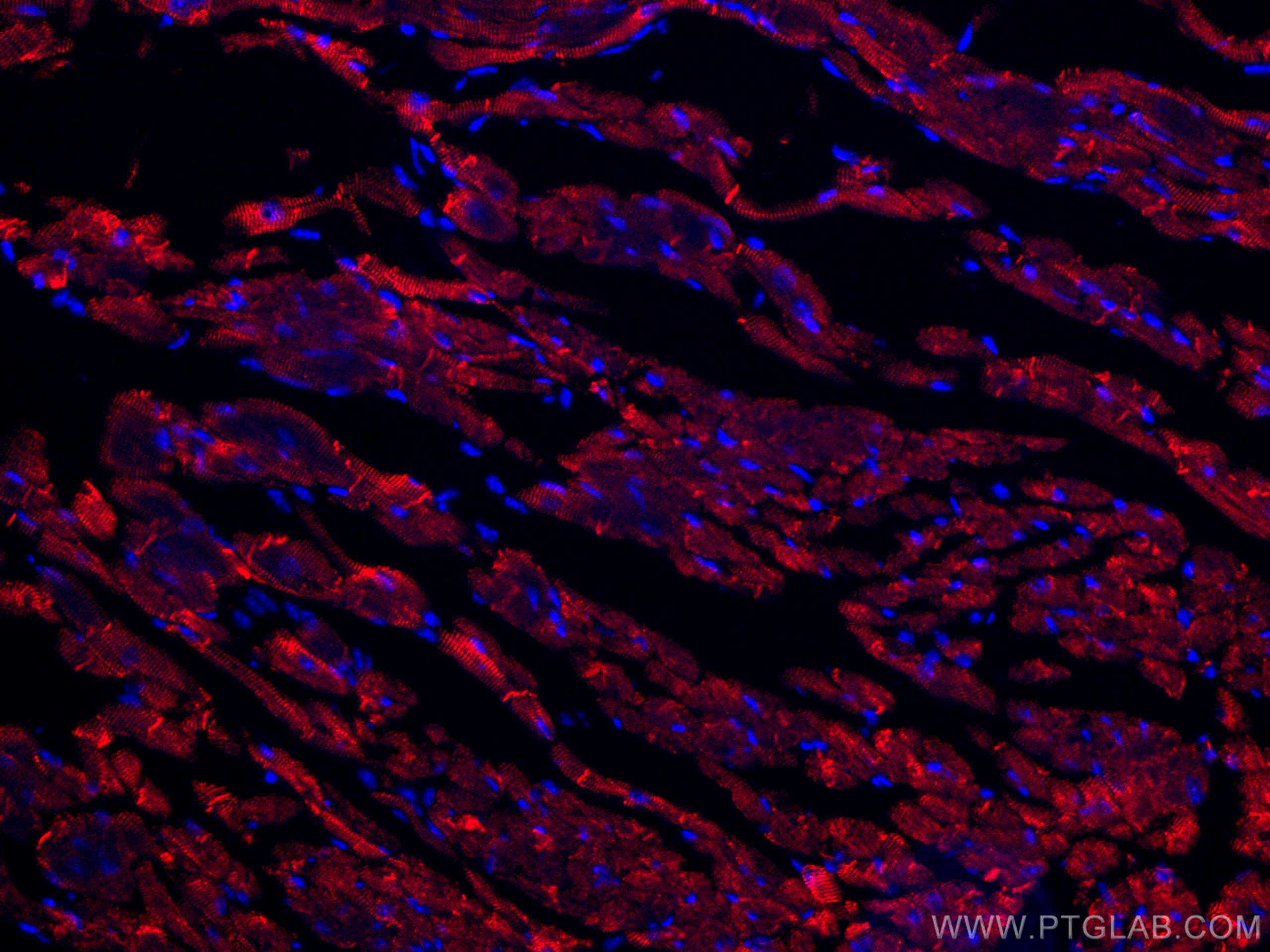 IF Staining of mouse heart using CL594-16520