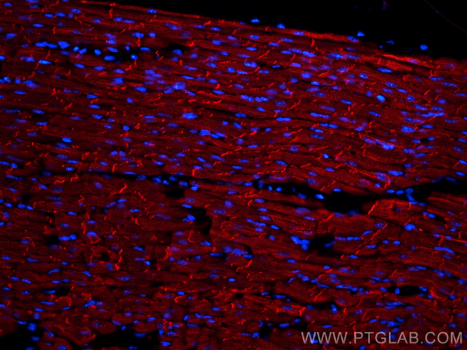 Immunofluorescence (IF) / fluorescent staining of mouse heart tissue using CoraLite®594-conjugated Desmin Polyclonal antibody (CL594-16520)