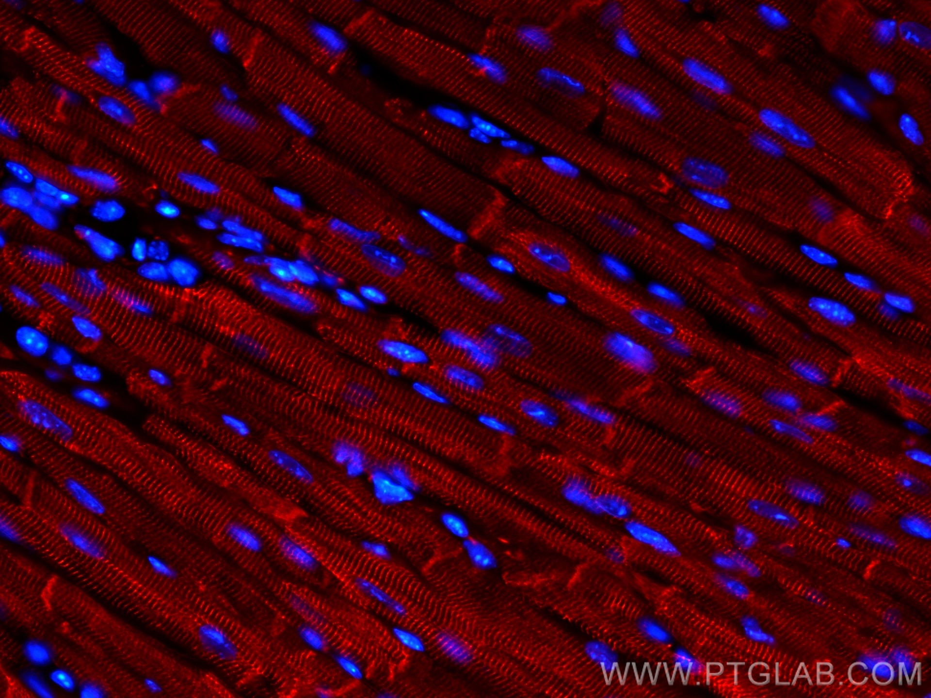 Immunofluorescence (IF) / fluorescent staining of mouse heart tissue using CoraLite®594-conjugated Desmin Polyclonal antibody (CL594-16520)