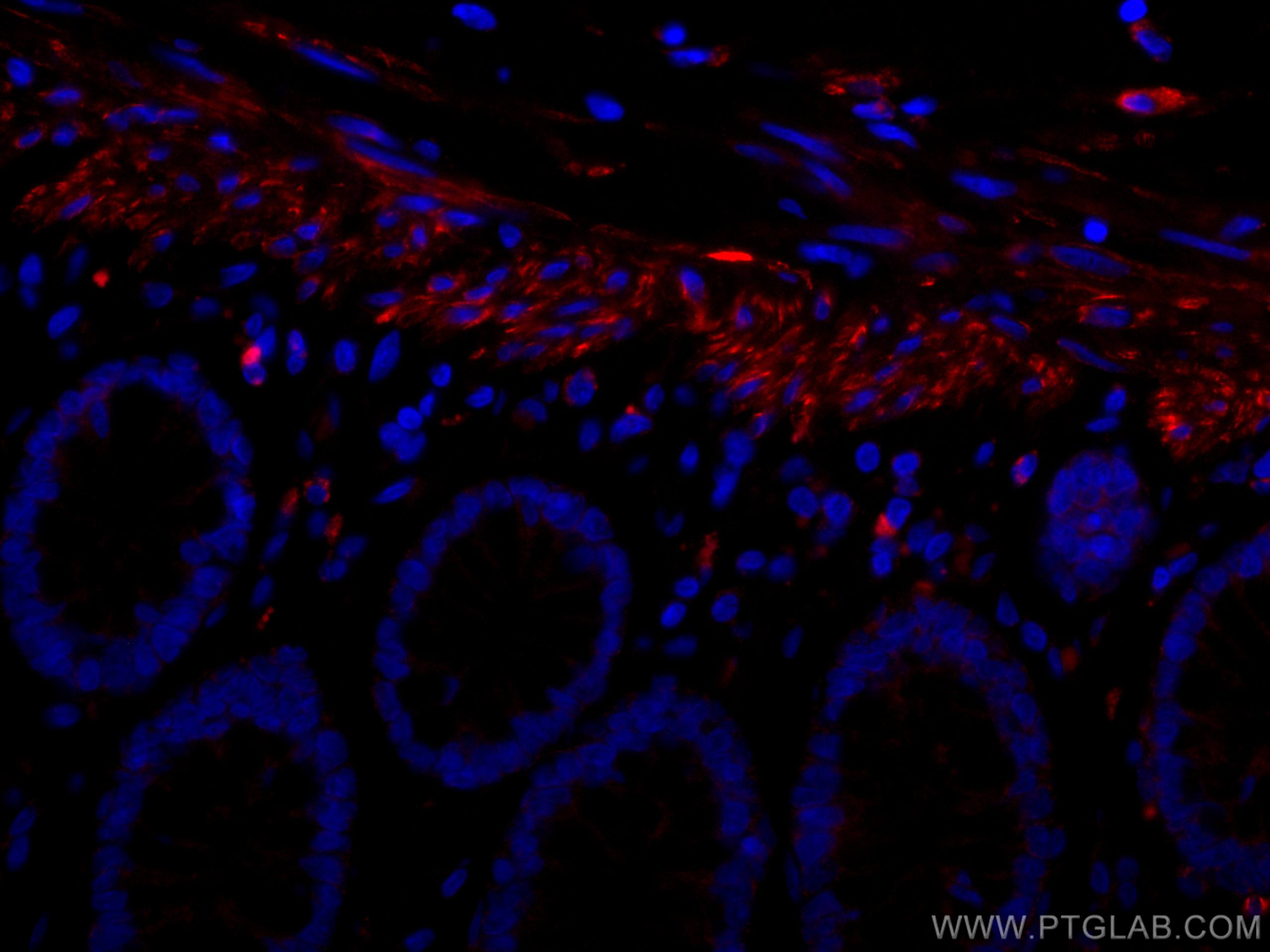 Immunofluorescence (IF) / fluorescent staining of human colon tissue using CoraLite®594-conjugated Desmin Monoclonal antibody (CL594-67793)