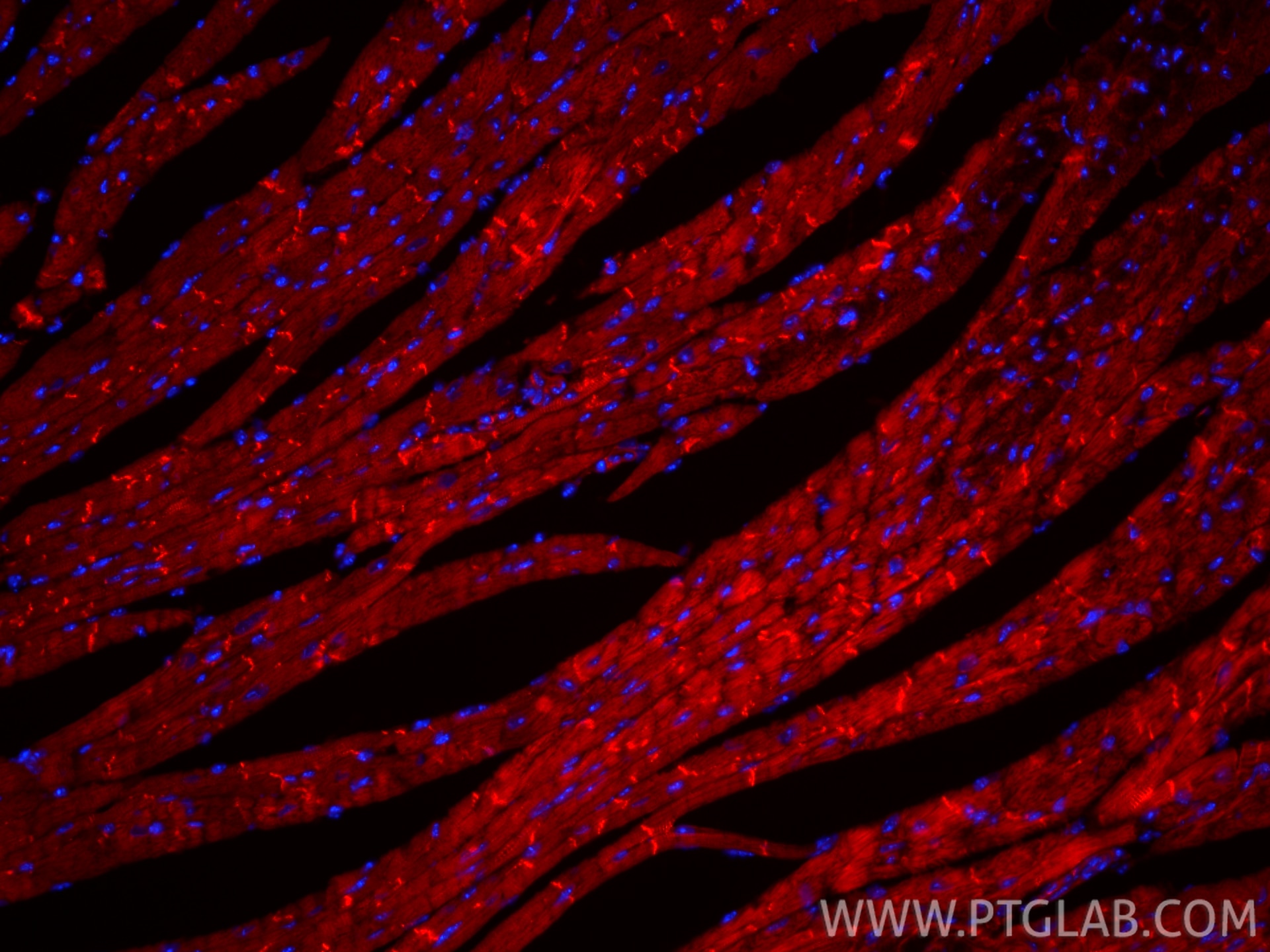 Immunofluorescence (IF) / fluorescent staining of mouse heart tissue using CoraLite®594-conjugated Desmin Recombinant monoclo (CL594-82748)