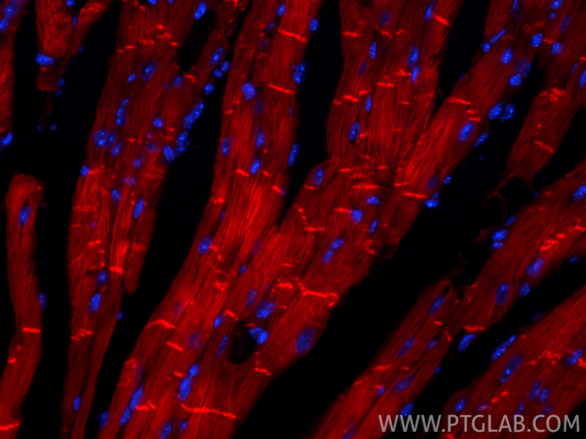 Immunofluorescence (IF) / fluorescent staining of mouse heart tissue using CoraLite®594-conjugated Desmin Recombinant monoclo (CL594-82748)