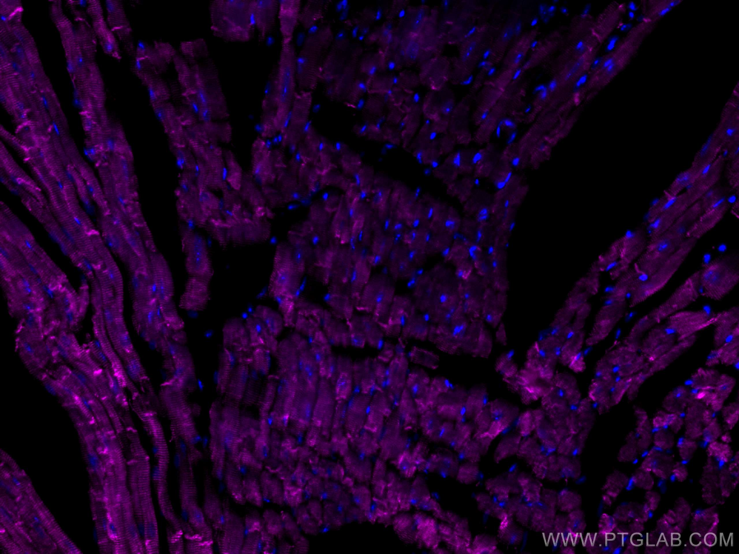 Immunofluorescence (IF) / fluorescent staining of mouse heart tissue using CoraLite®647-conjugated Desmin Polyclonal antibody (CL647-16520)