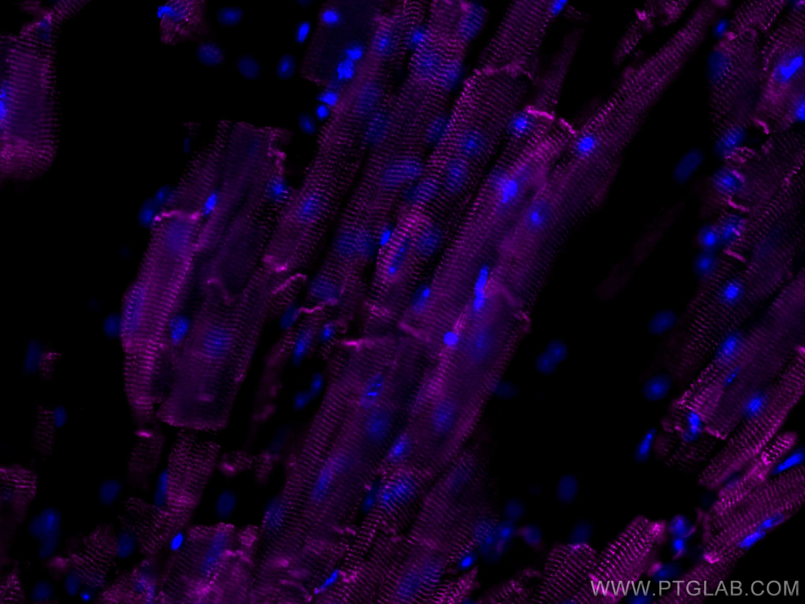 Immunofluorescence (IF) / fluorescent staining of mouse heart tissue using CoraLite® Plus 647-conjugated Desmin Polyclonal an (CL647-16520)