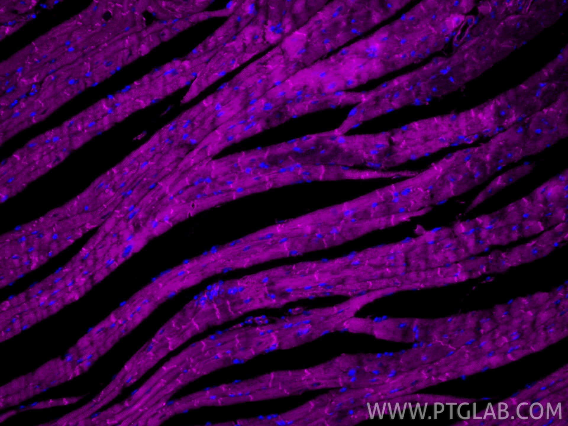 Immunofluorescence (IF) / fluorescent staining of mouse heart tissue using CoraLite® Plus 647-conjugated Desmin Recombinant m (CL647-82748)