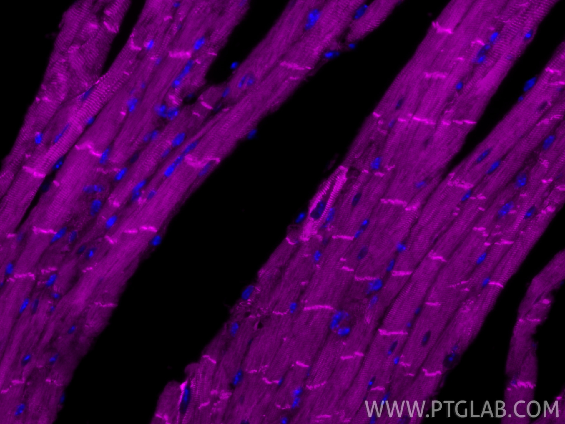Immunofluorescence (IF) / fluorescent staining of mouse heart tissue using CoraLite® Plus 647-conjugated Desmin Recombinant m (CL647-82748)