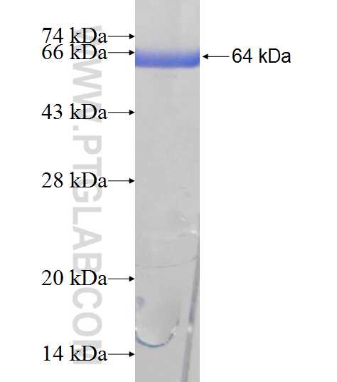 Desmin fusion protein Ag9742 SDS-PAGE