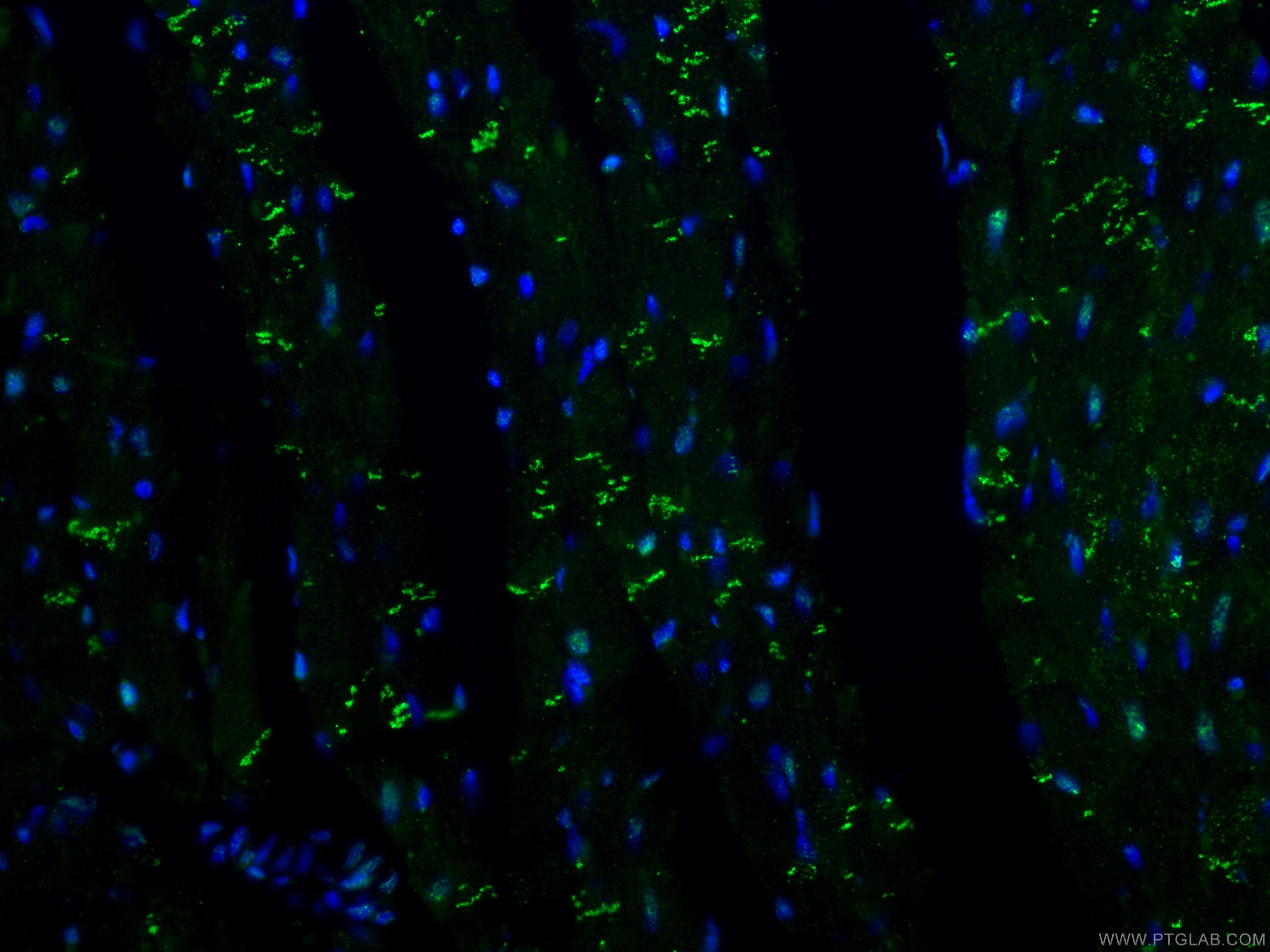 Immunofluorescence (IF) / fluorescent staining of rat heart tissue using Desmoplakin Polyclonal antibody (25318-1-AP)