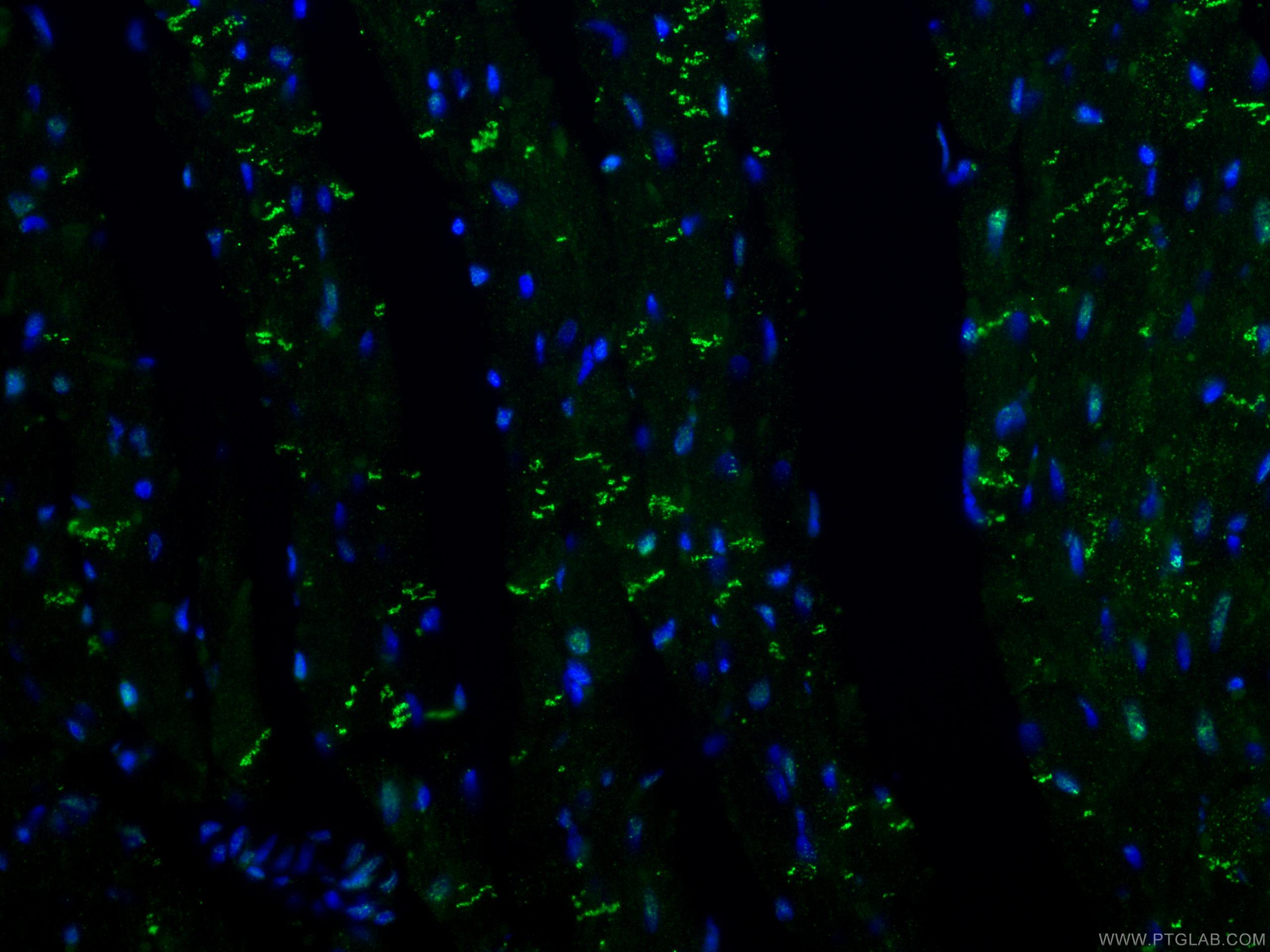 IF Staining of rat heart using 25318-1-AP