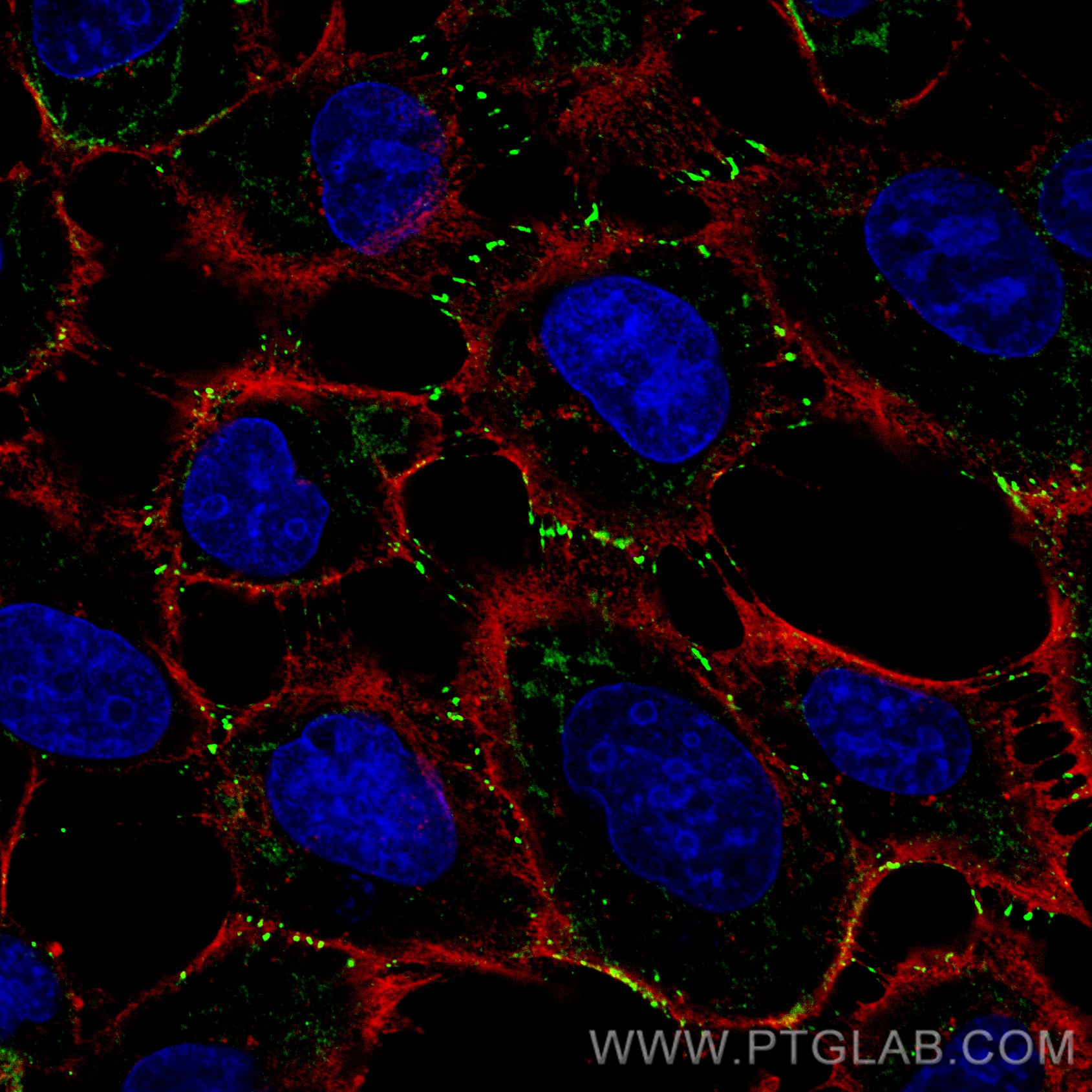 IF Staining of A431 using 25318-1-AP