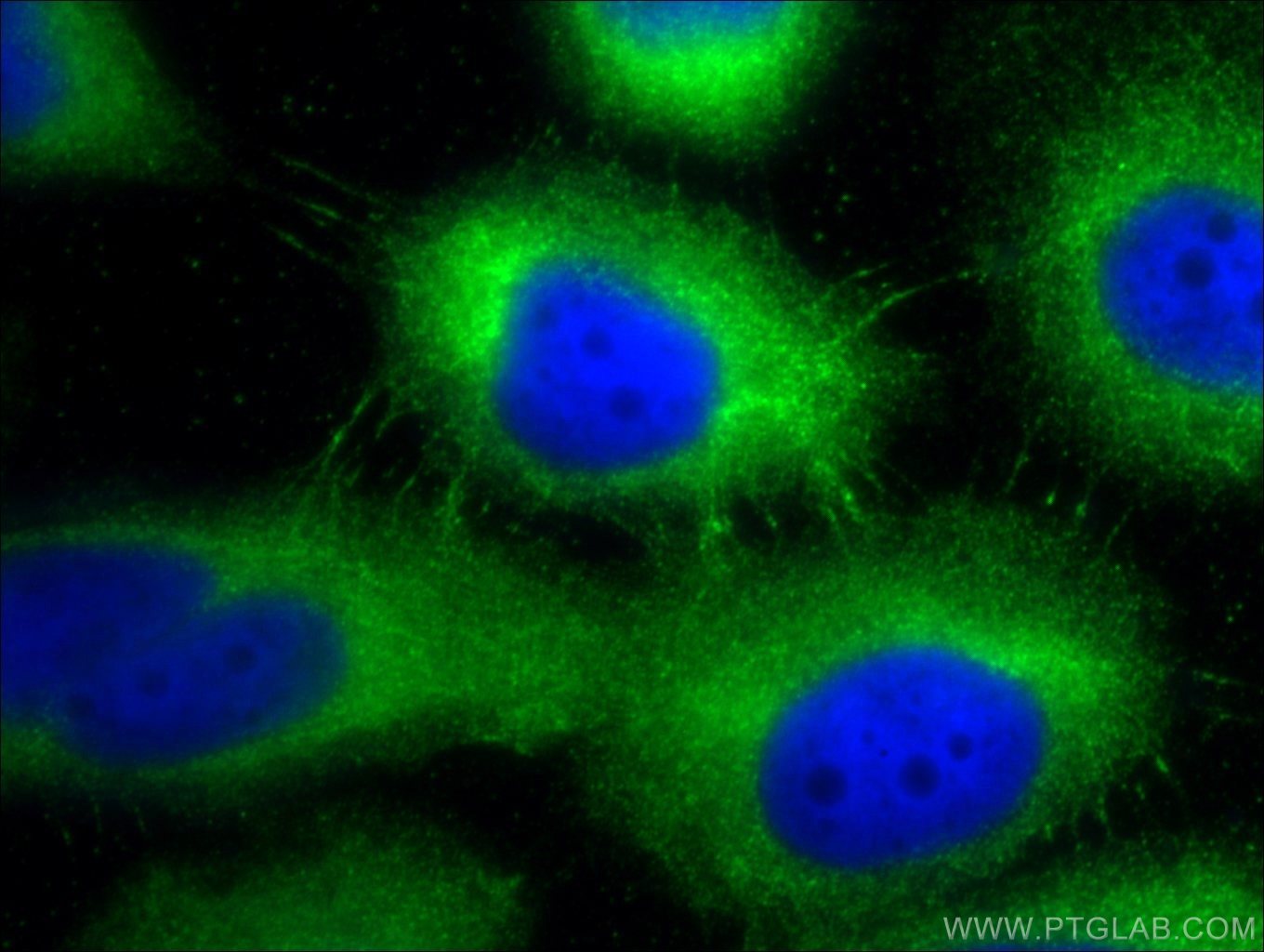 Immunofluorescence (IF) / fluorescent staining of A431 cells using Desmoplakin Polyclonal antibody (25318-1-AP)