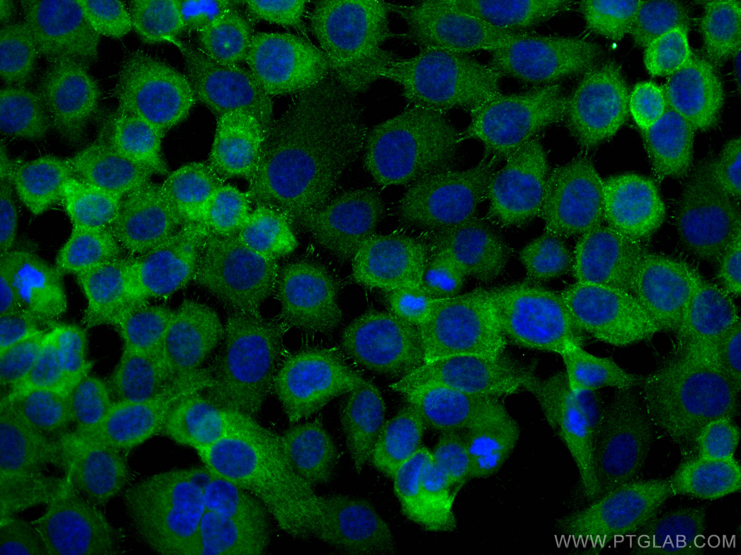 Immunofluorescence (IF) / fluorescent staining of A431 cells using Desmoplakin Polyclonal antibody (25318-1-AP)
