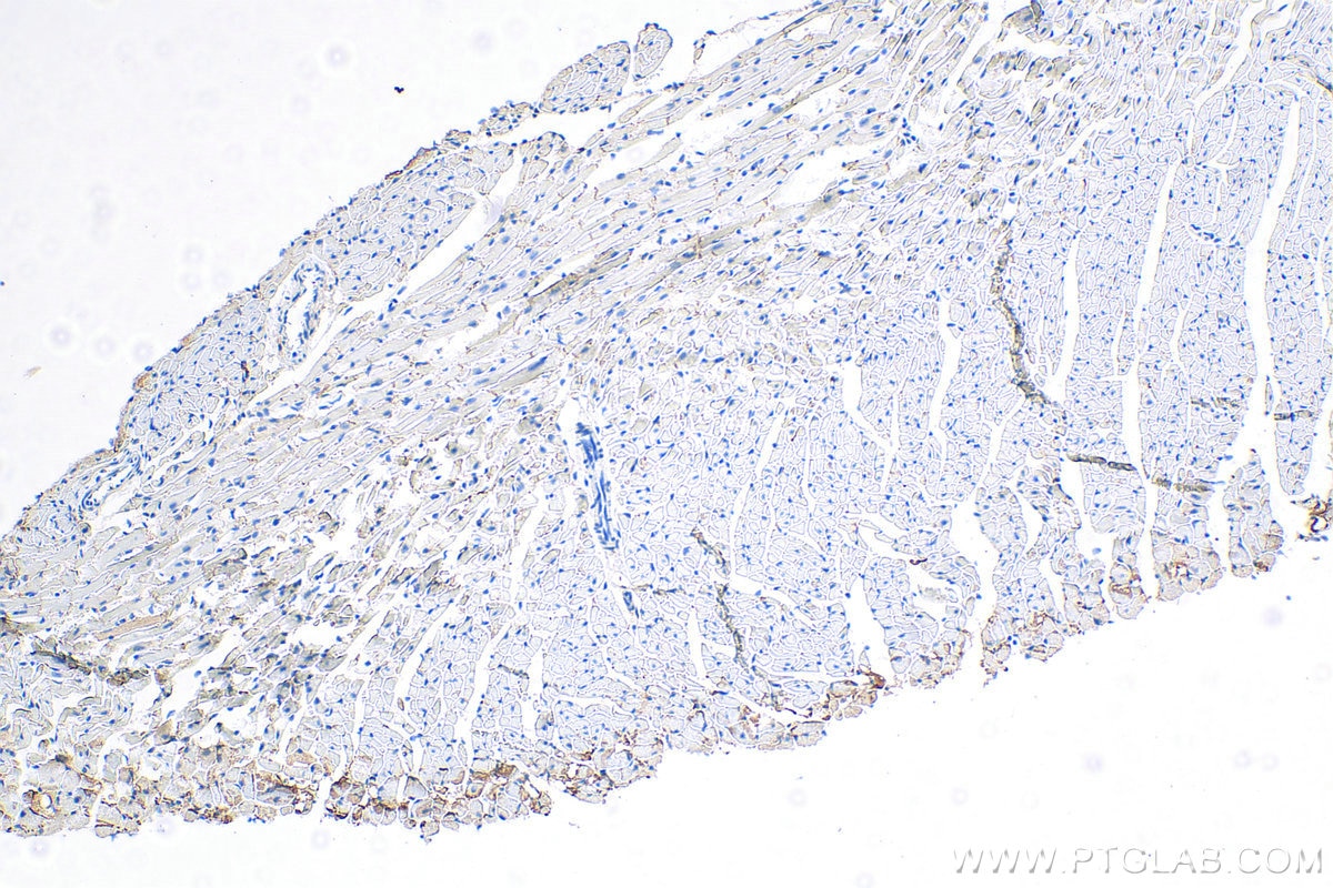 IHC staining of mouse heart using 25318-1-PBS