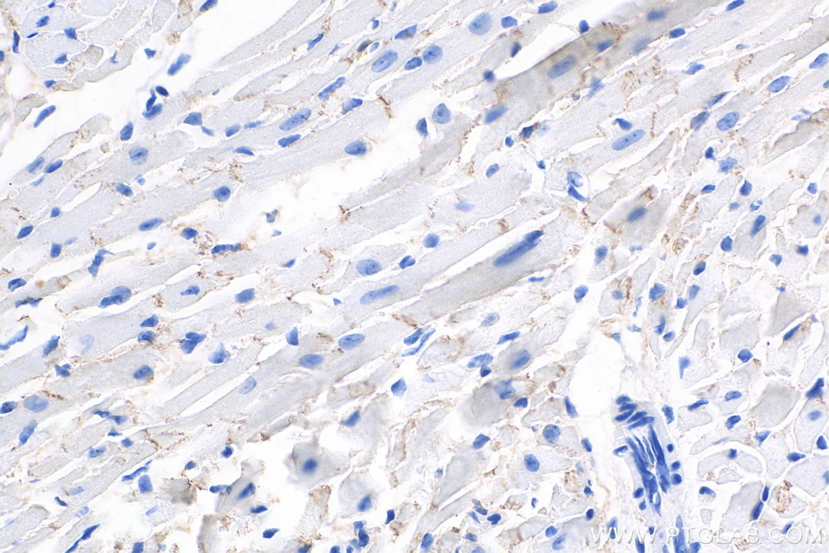 Immunohistochemistry (IHC) staining of mouse heart tissue using Desmoplakin Polyclonal antibody (25318-1-PBS)