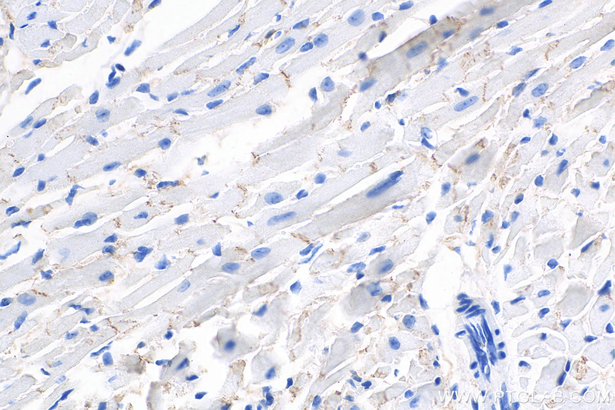 Immunohistochemistry (IHC) staining of mouse heart tissue using Desmoplakin Polyclonal antibody (25318-1-PBS)