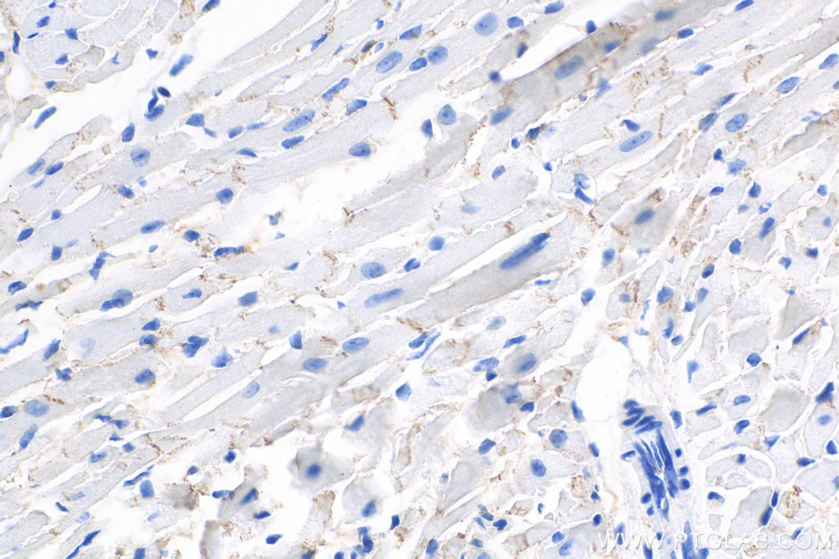 IHC staining of mouse heart using 25318-1-PBS