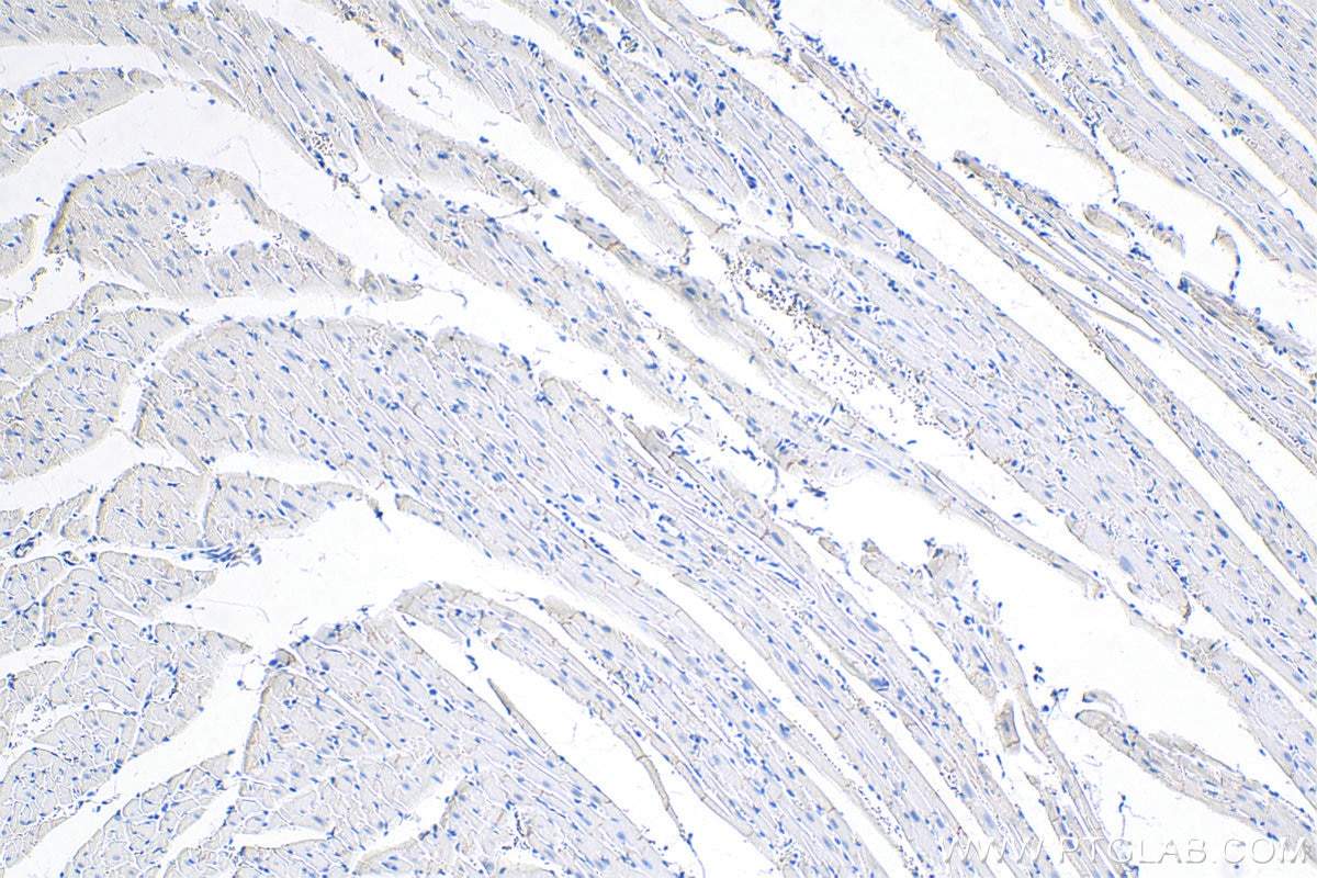 Immunohistochemistry (IHC) staining of rat heart tissue using Desmoplakin Polyclonal antibody (25318-1-PBS)