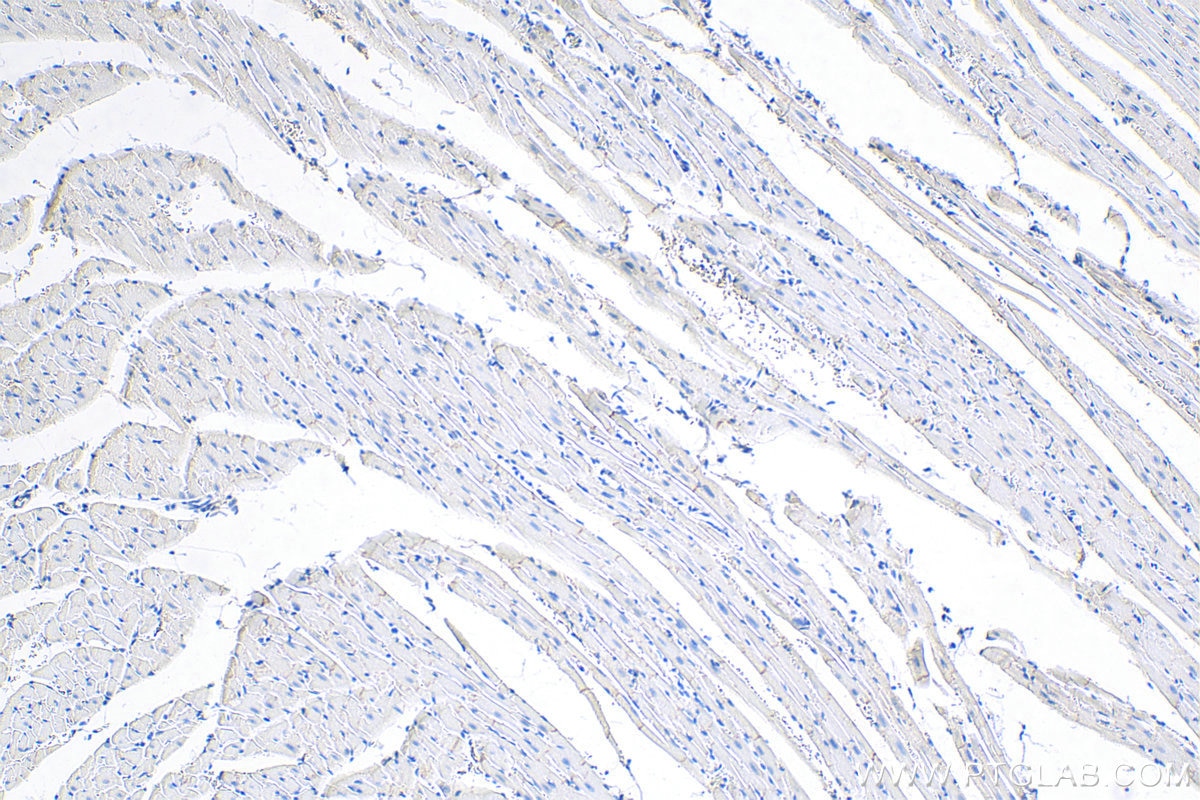 Immunohistochemistry (IHC) staining of rat heart tissue using Desmoplakin Polyclonal antibody (25318-1-PBS)