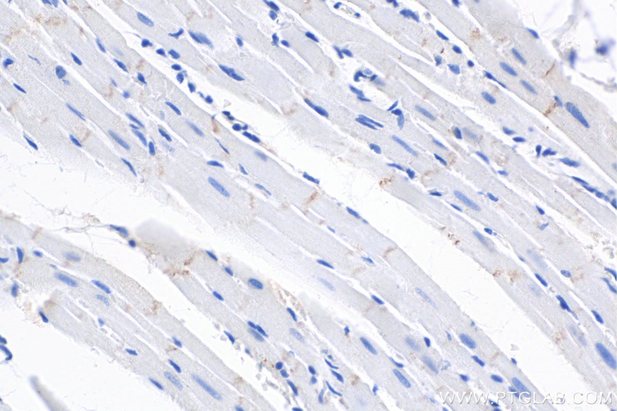 Immunohistochemistry (IHC) staining of rat heart tissue using Desmoplakin Polyclonal antibody (25318-1-AP)